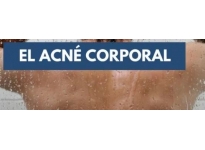 Acné Corporal